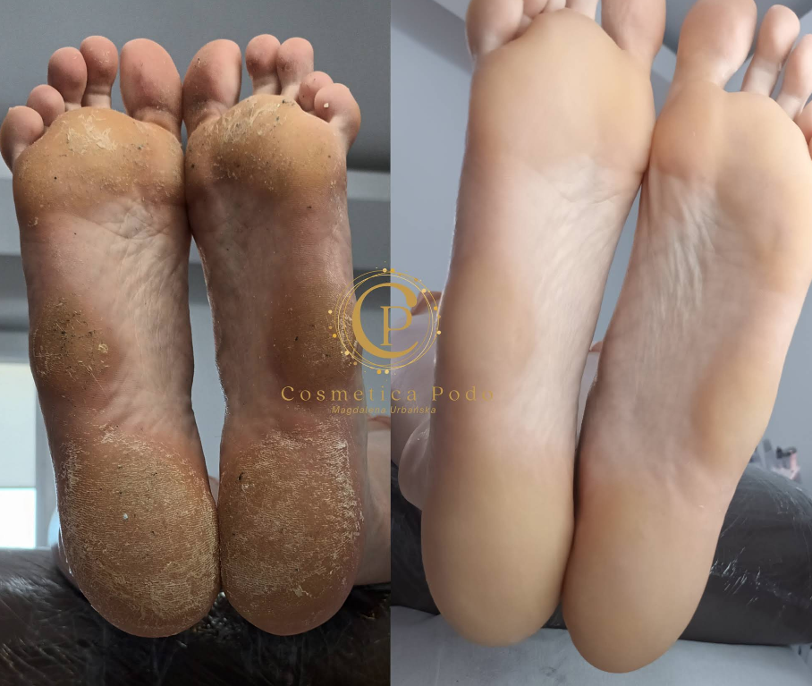 Lecznicze Zabiegi Podologiczne