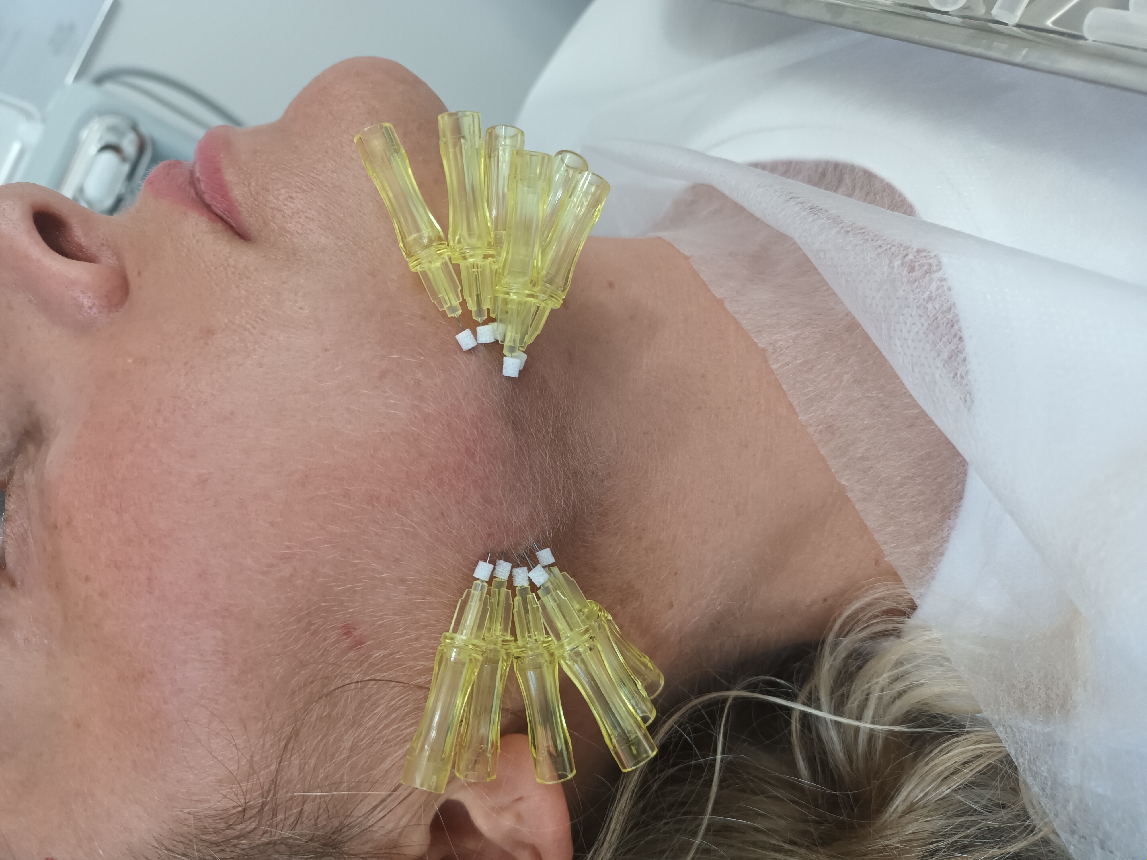 Kosmetologia Estetyczna