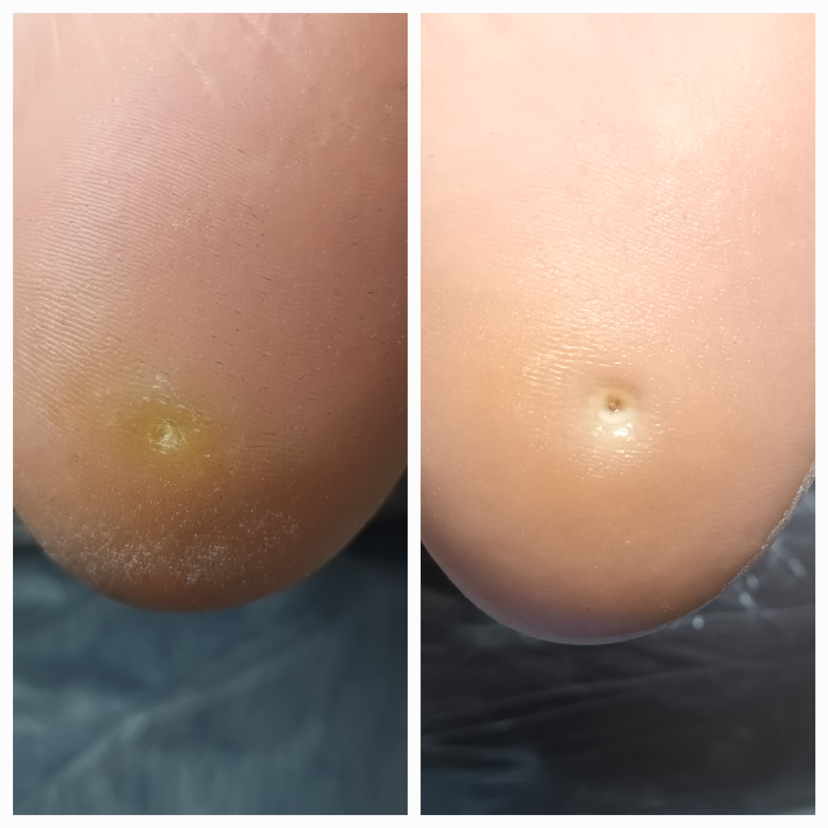 Usuwanie modzeli i odcisków - zdjęcie 10