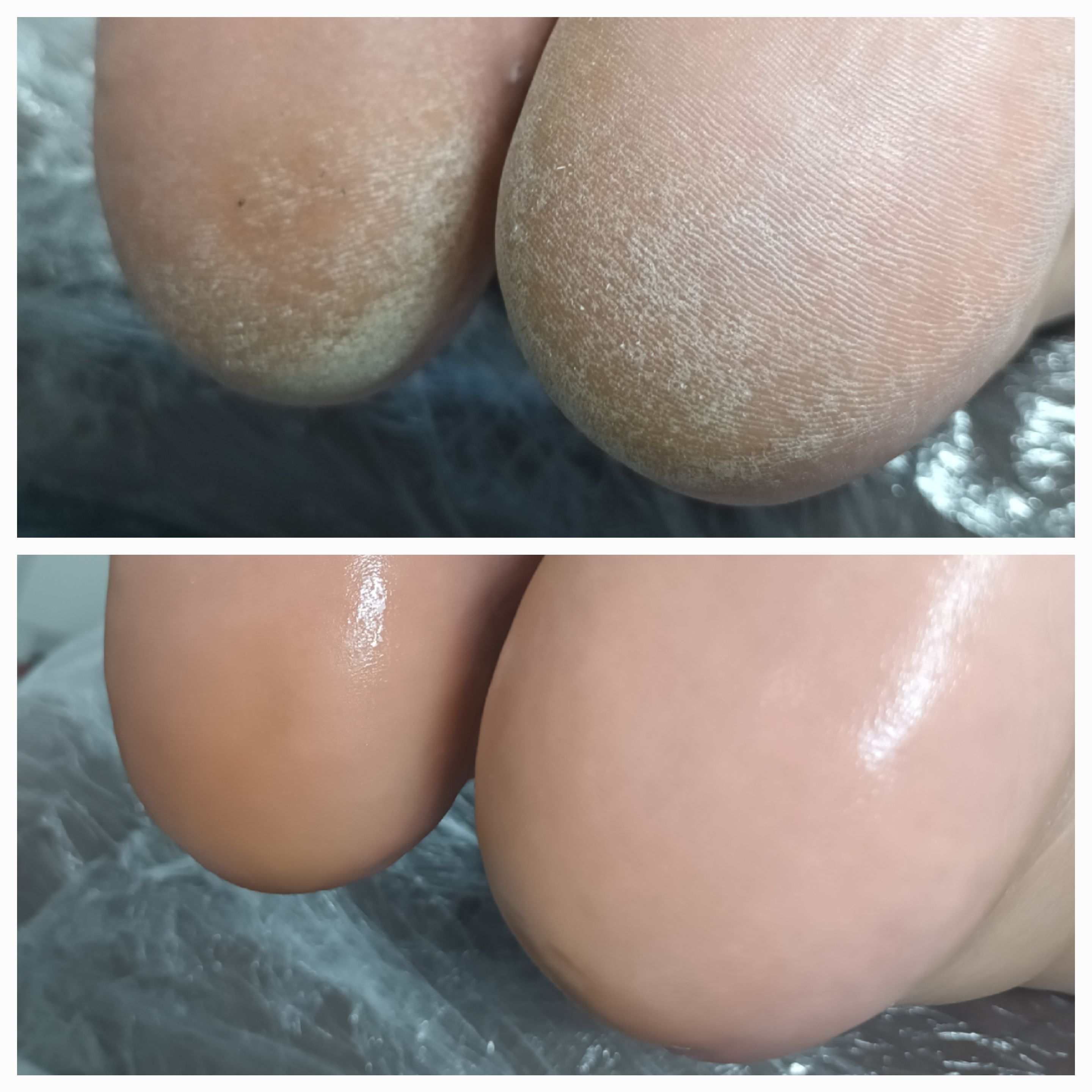 Pedicure kosmetyczny - zdjęcie 10