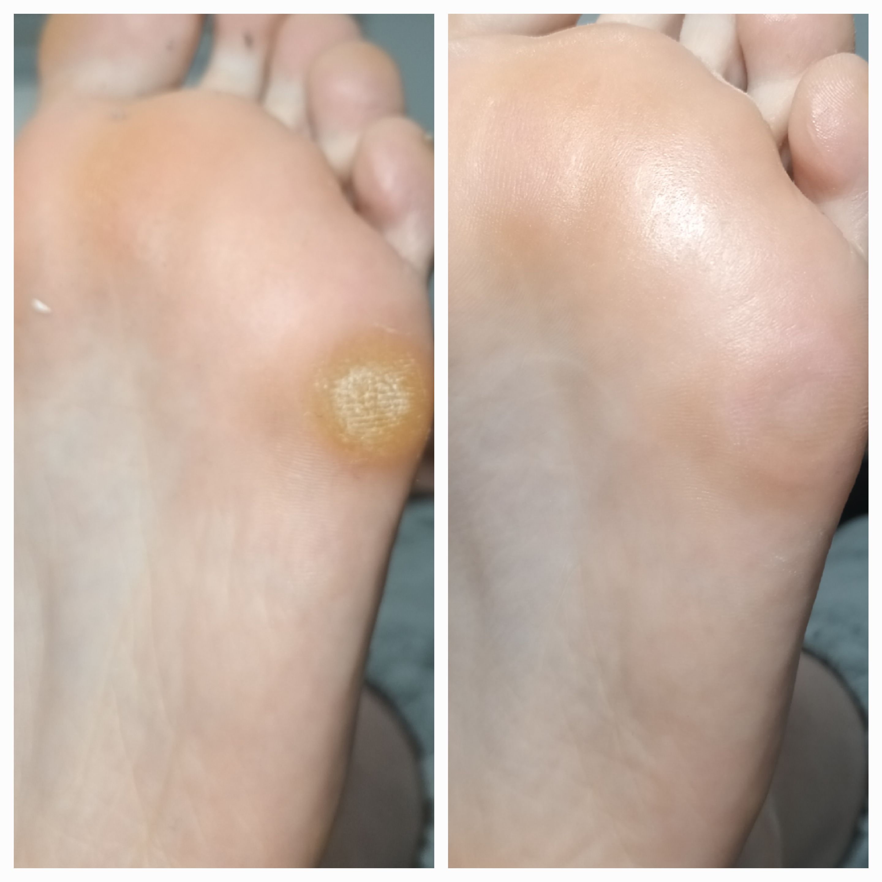 Usuwanie modzeli i odcisków - zdjęcie 11