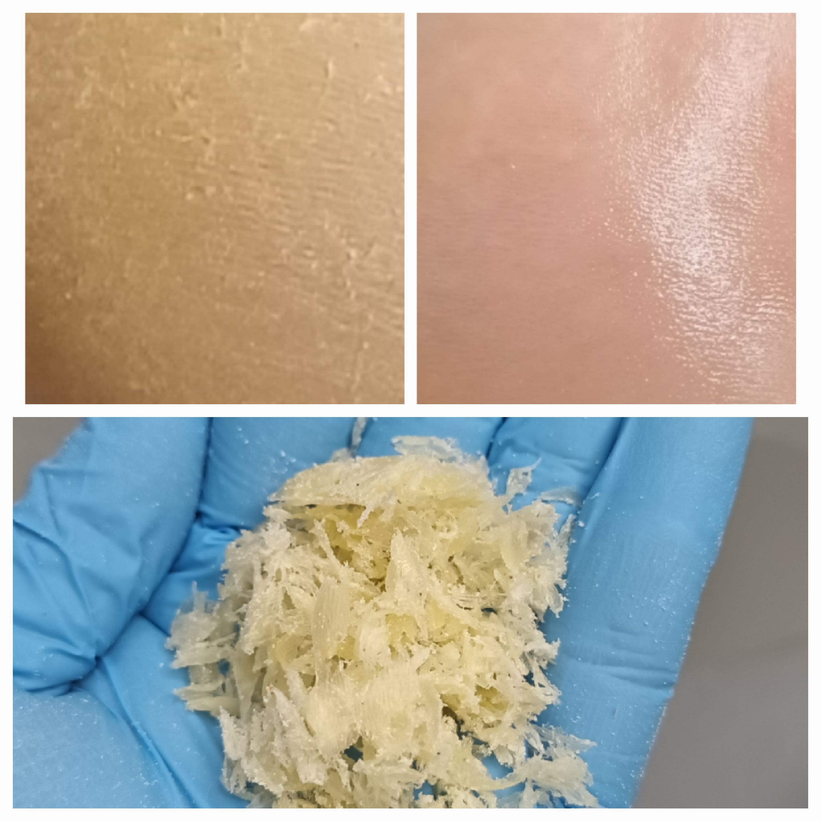 Pedicure leczniczy - zdjęcie 12