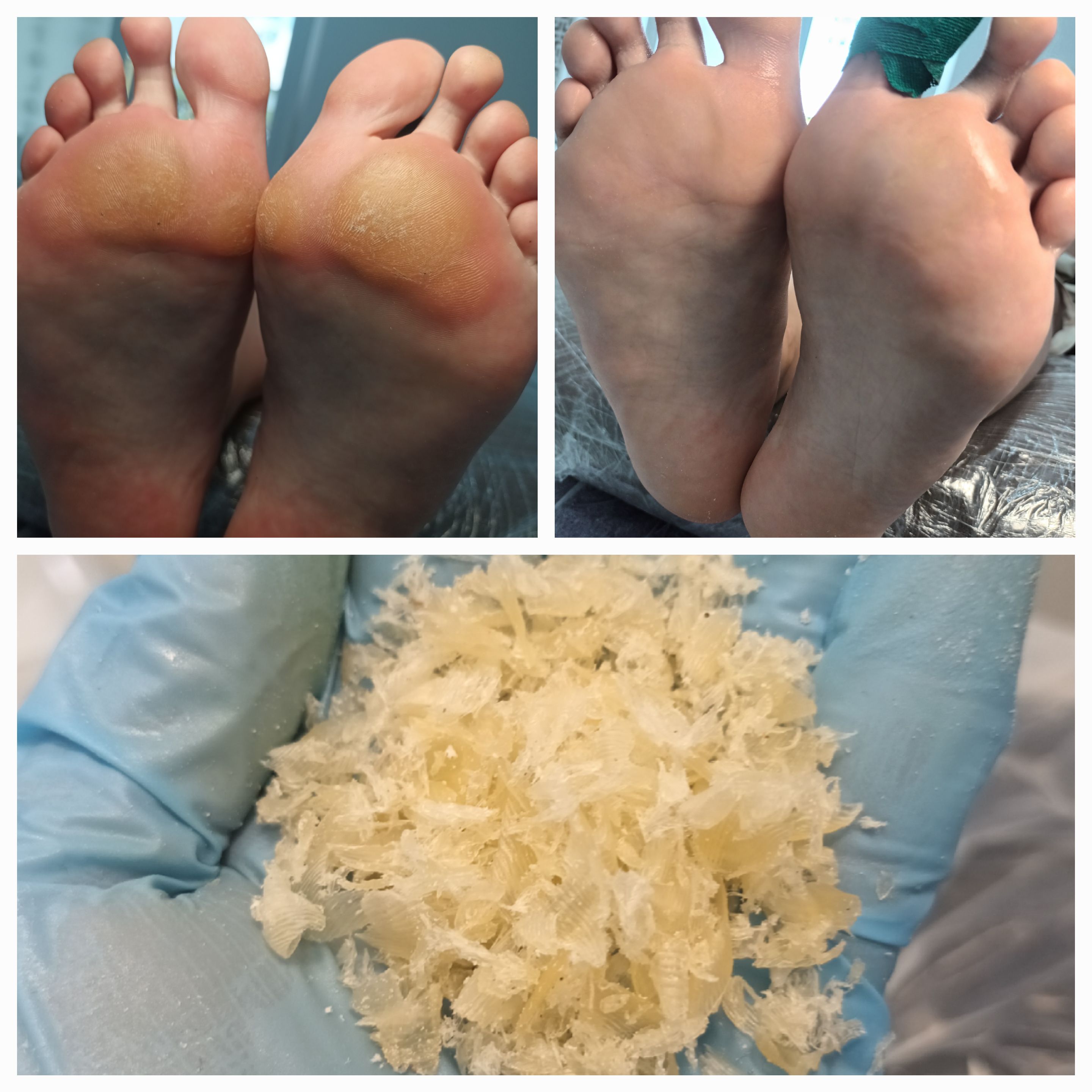 Pedicure leczniczy - zdjęcie 13