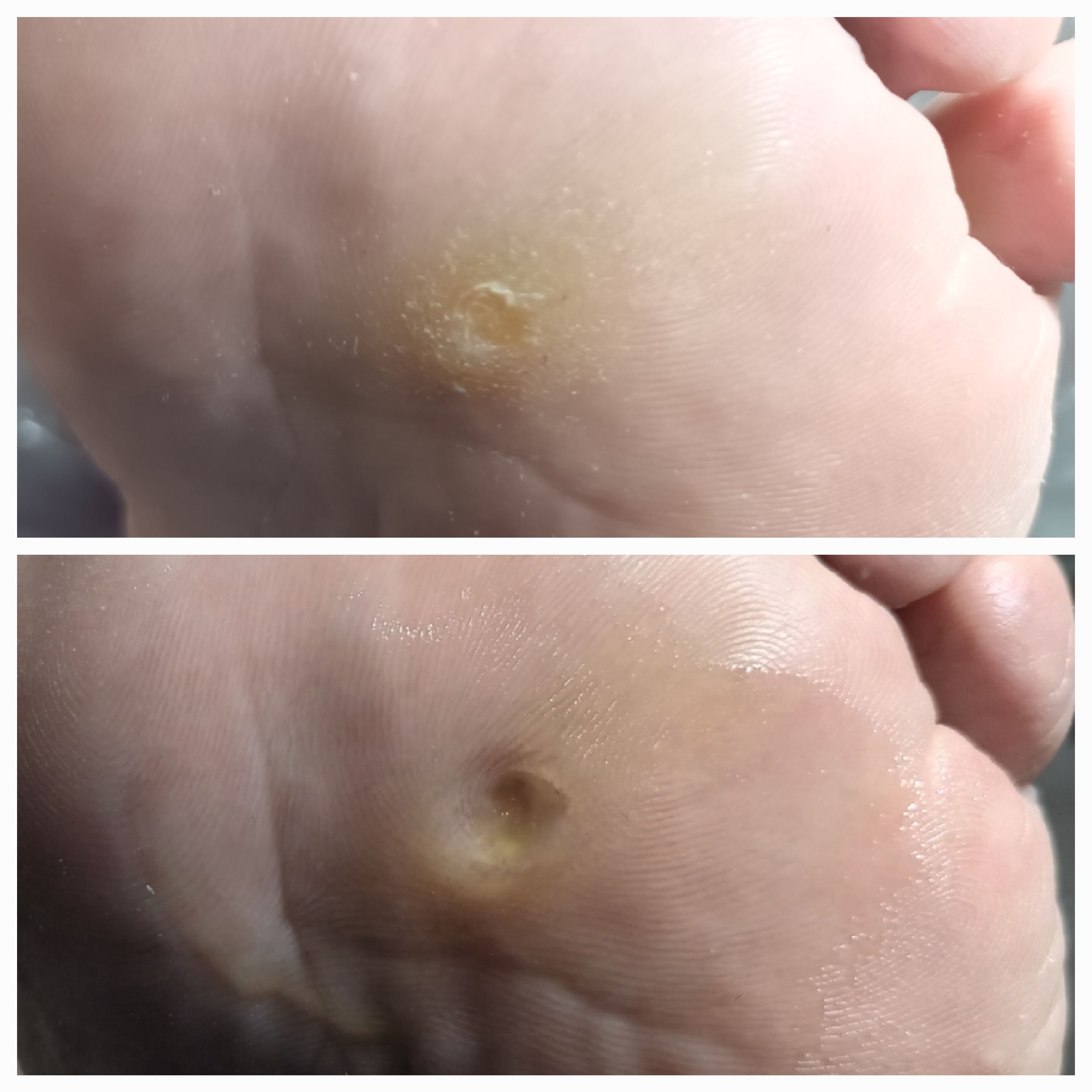 Usuwanie modzeli i odcisków - zdjęcie 13