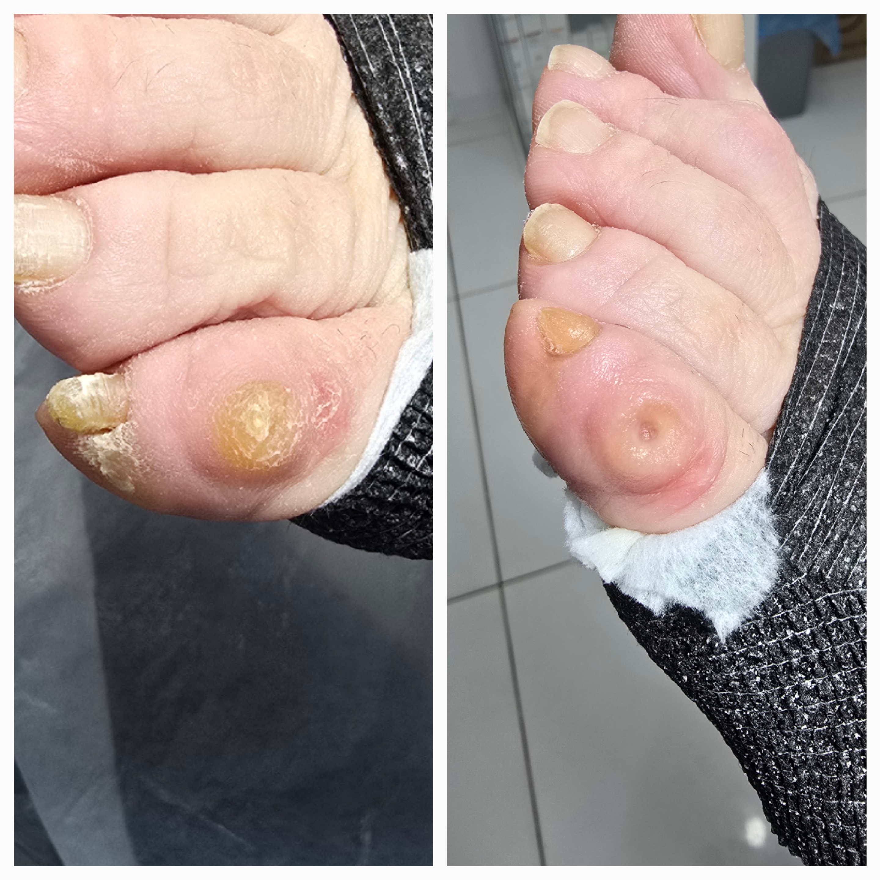 Usuwanie modzeli i odcisków - zdjęcie 16