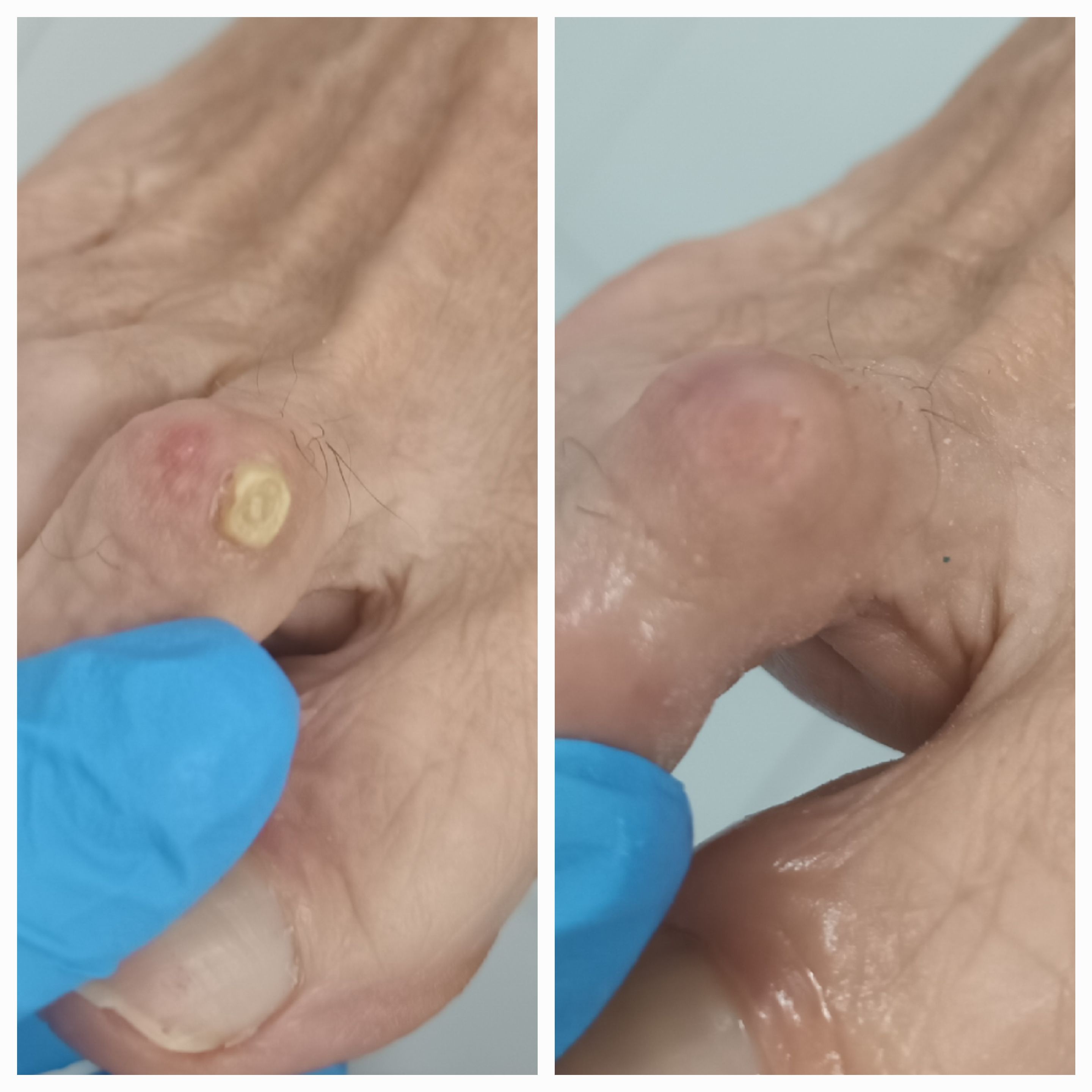 Usuwanie modzeli i odcisków - zdjęcie 1