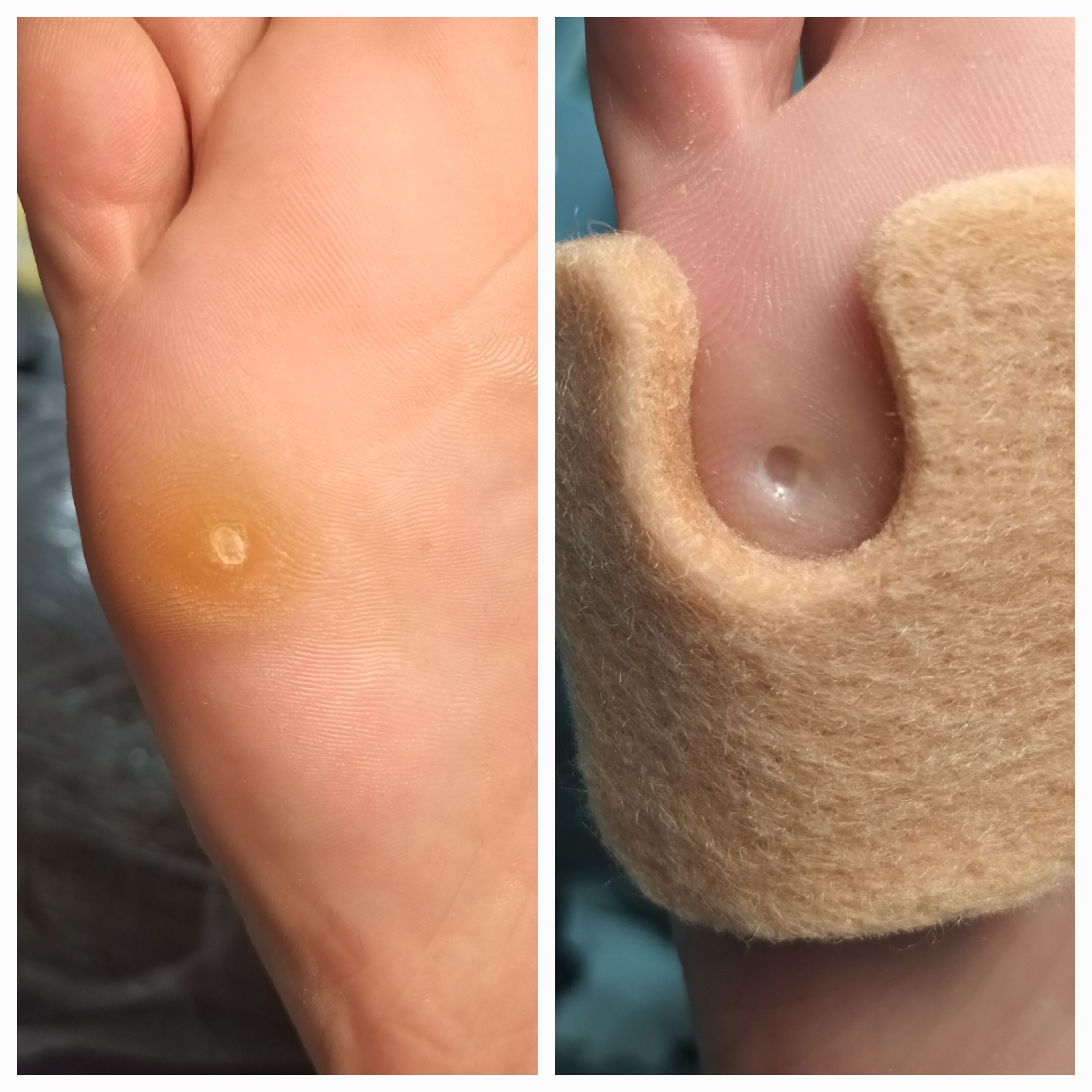 Usuwanie modzeli i odcisków - zdjęcie 3