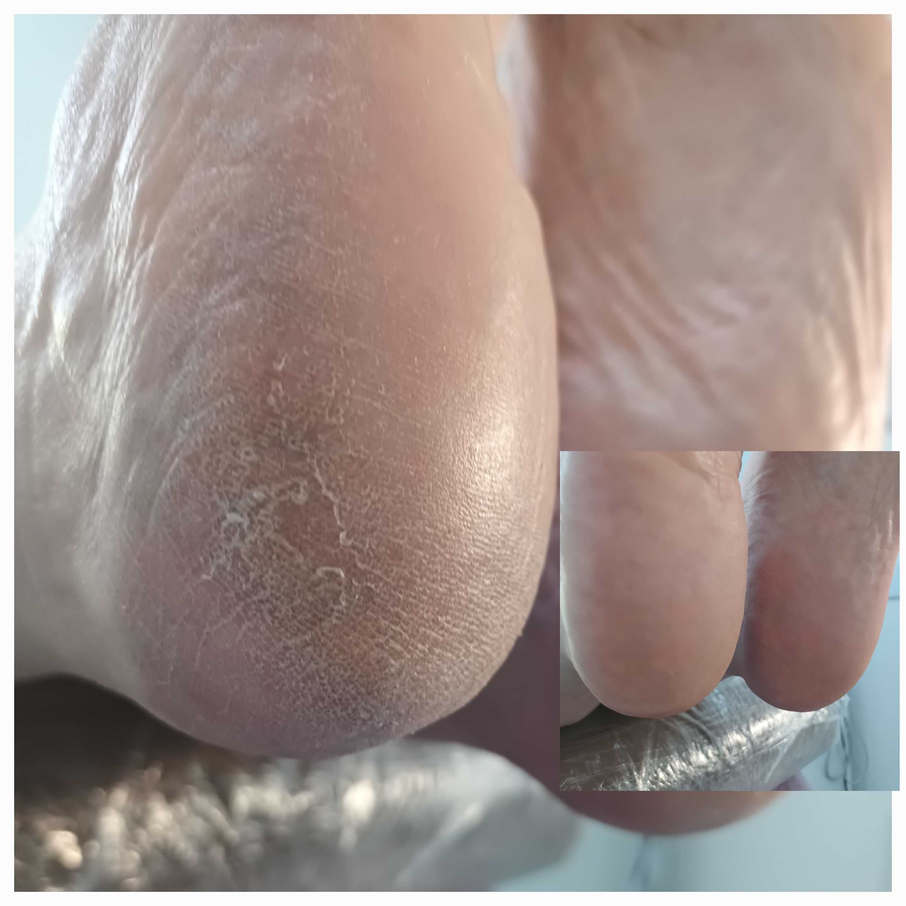 Pedicure kosmetyczny - zdjęcie 4