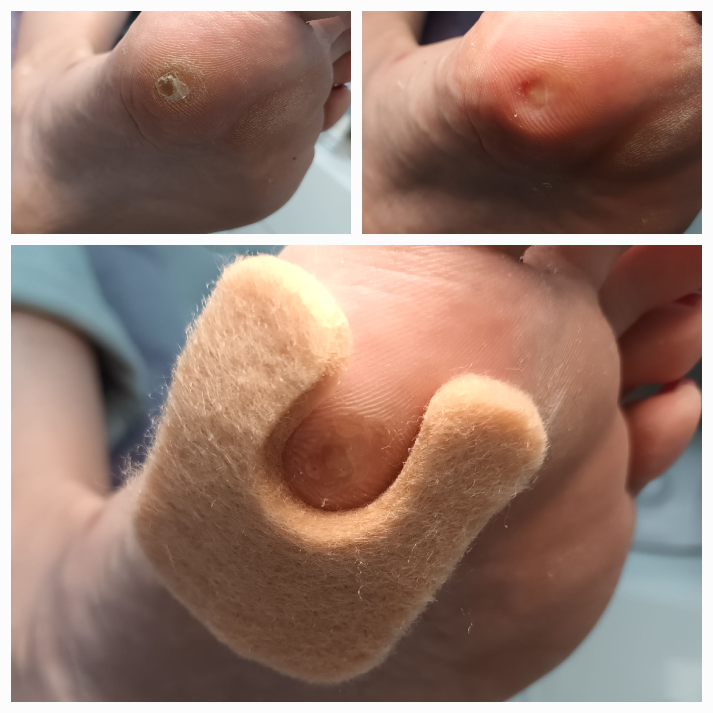 Usuwanie modzeli i odcisków - zdjęcie 5