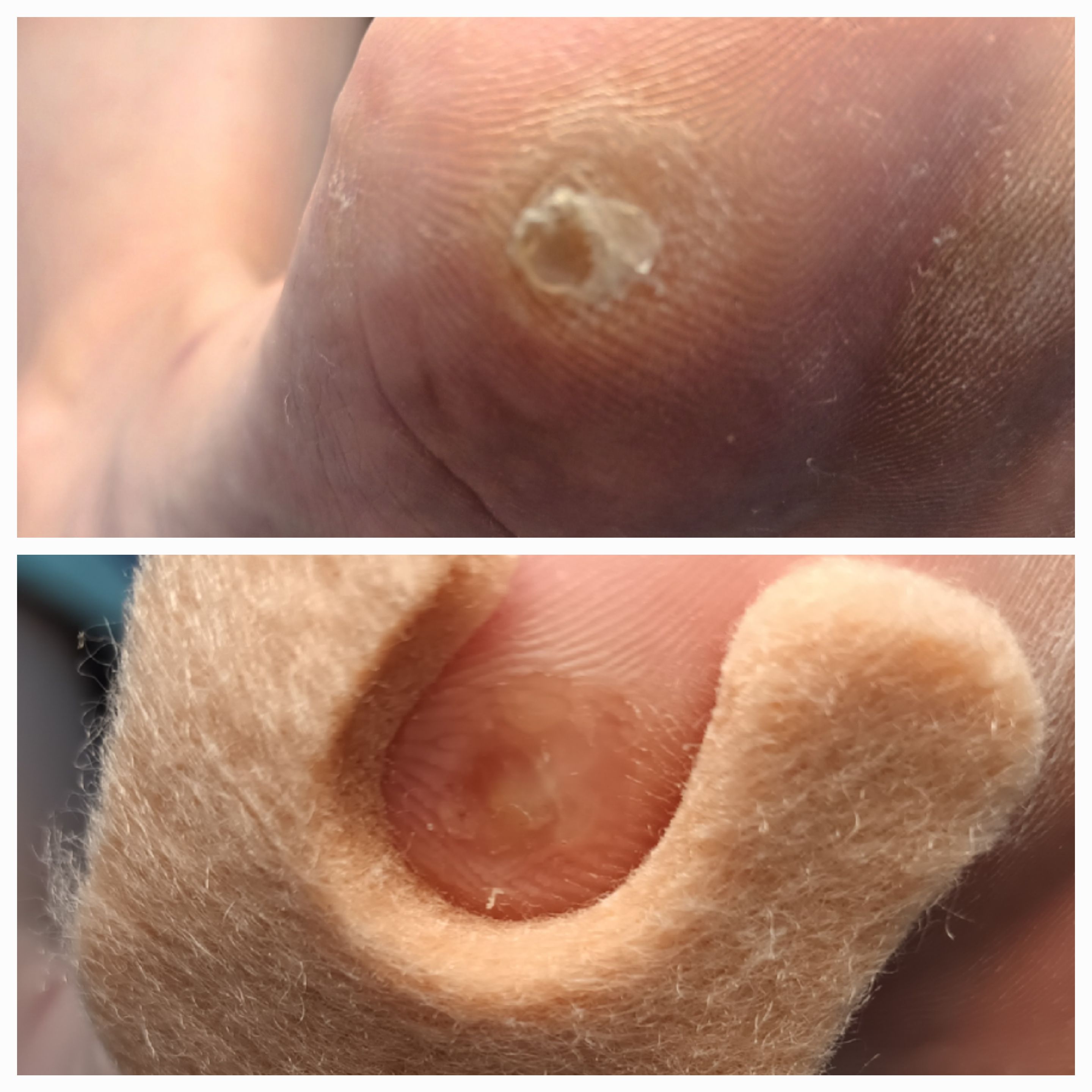 Usuwanie modzeli i odcisków - zdjęcie 6