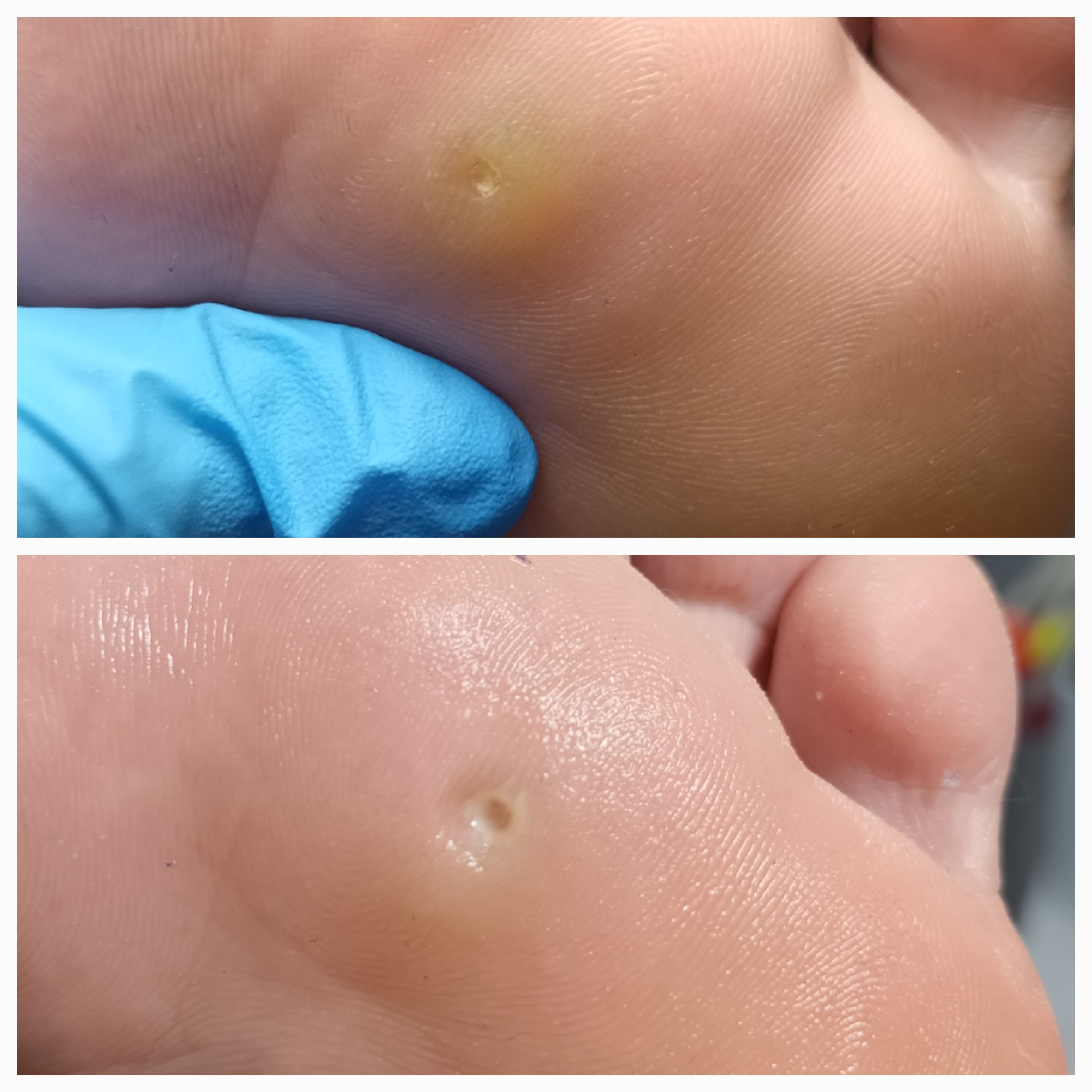 Usuwanie modzeli i odcisków - zdjęcie 9