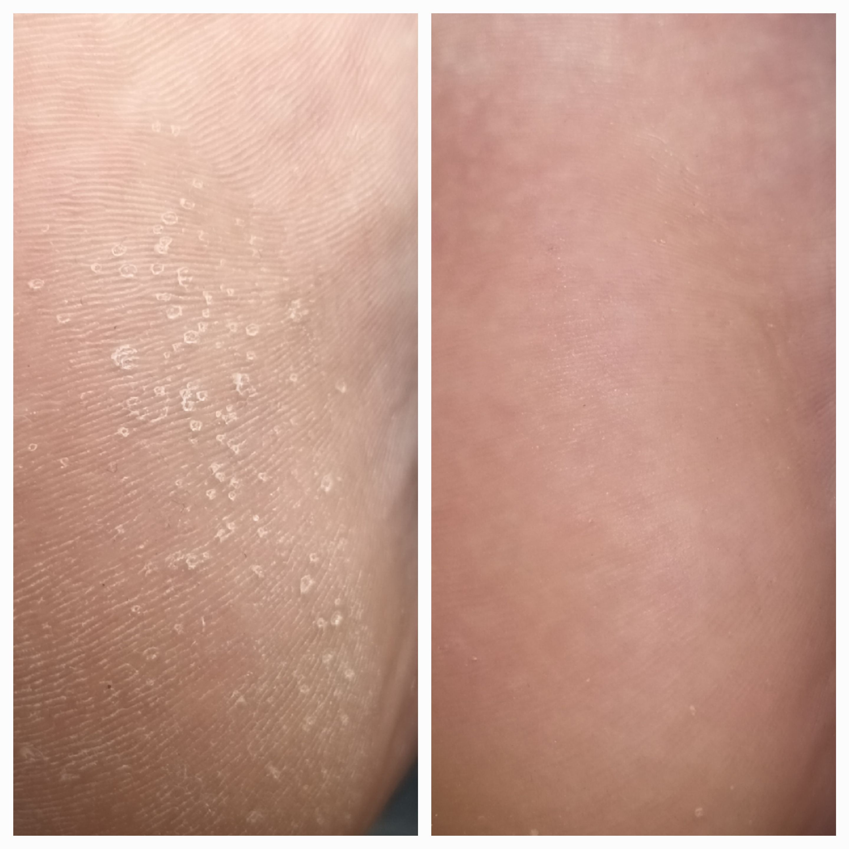 Pedicure kosmetyczny - zdjęcie 9