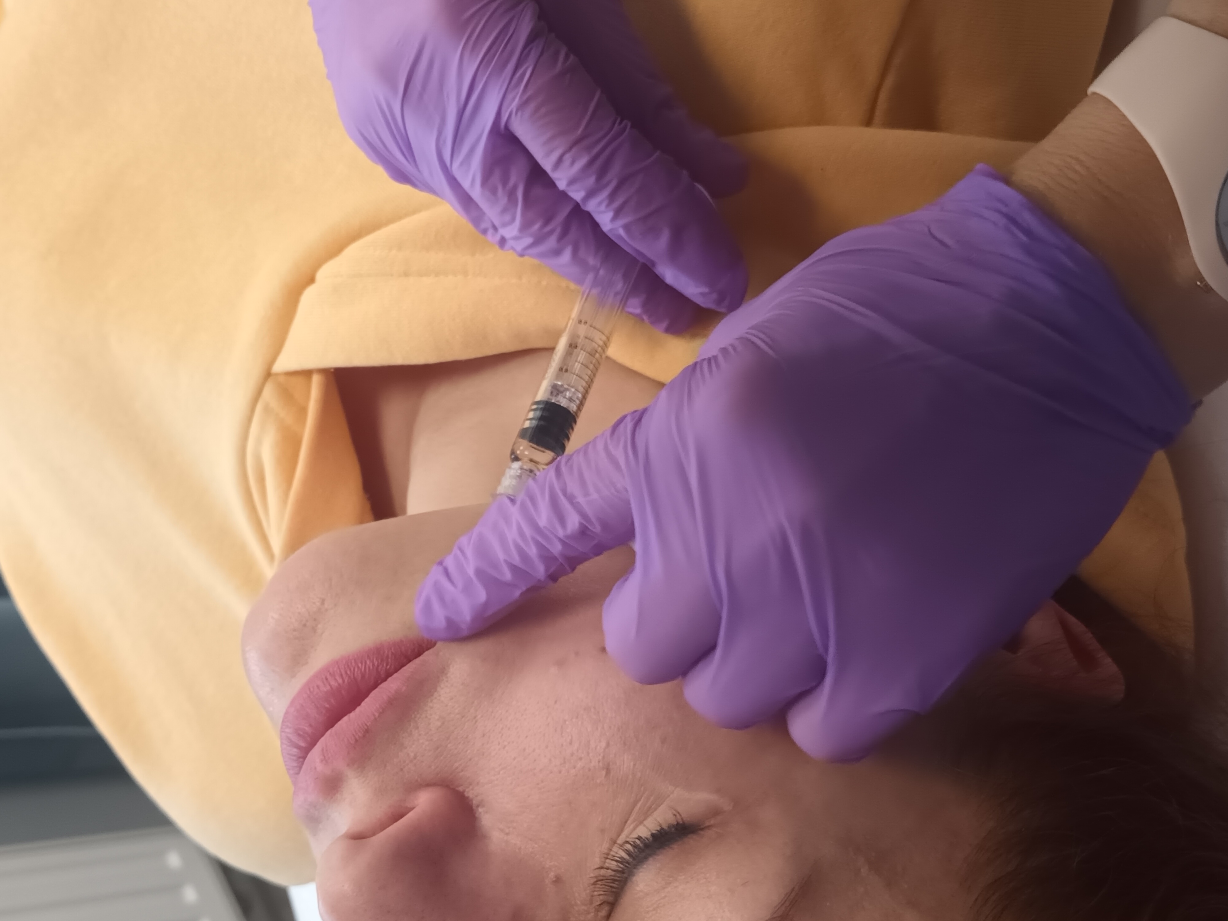 Mezoterapia, lipoliza i stymulatory - zdjęcie 7